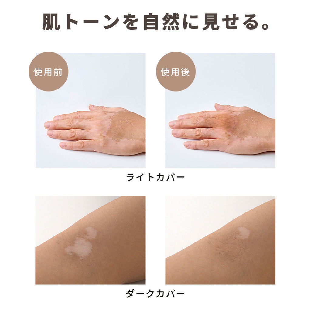 MELAFIL ペン+リキッド カバー ブラシ 小 セット 白斑 韓国製
