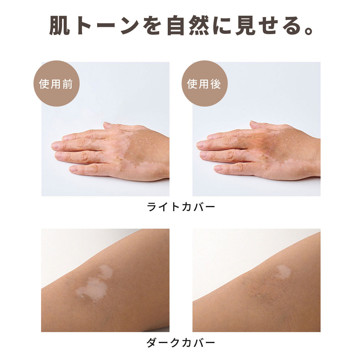 MELAFIL 白斑 専用 ペン コンシーラー カバー 着色 韓国製