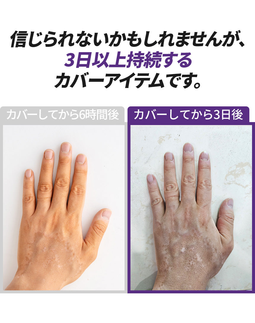 MELAFIL　ムース　カバー コンシーラー 　グローブ　セット　白斑 韓国製